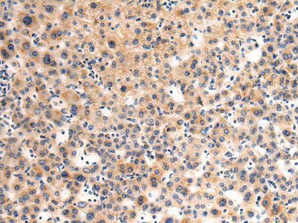 GLT8D1 Polyclonal Antibody (E-AB-53191)