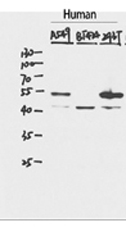 P53 Polyclonal Antibody (E-AB-32469)