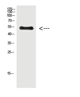 Phospho-Vimentin (Tyr38) Polyclonal Antibody (E-AB-51042)