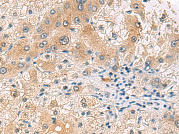 RNF13 Polyclonal Antibody (E-AB-52925)