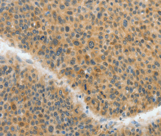 ACLY Polyclonal Antibody (E-AB-10986)