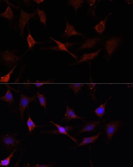GPER1 Polyclonal Antibody (E-AB-65746)