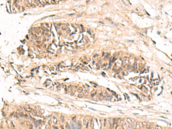 ABCB4 Polyclonal Antibody (E-AB-19432)