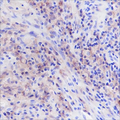 Recombinant CD33 Monoclonal Antibody (AN301475L)