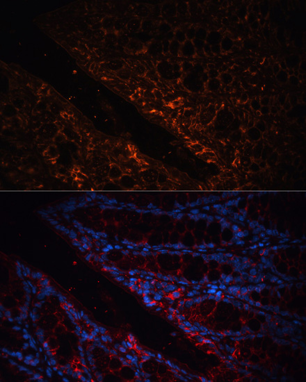 GPA33 Polyclonal Antibody (E-AB-65209)