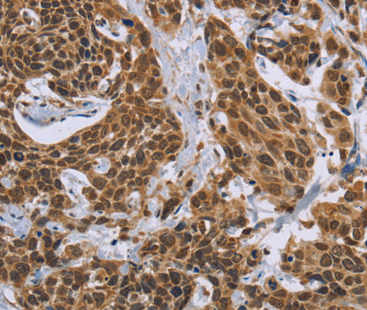CCL21 Polyclonal Antibody (E-AB-10215)