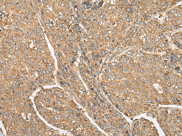 C5AR1 Polyclonal Antibody (E-AB-18573)