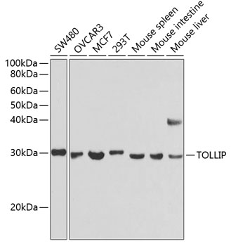TOLLIP Polyclonal Antibody (E-AB-60682)