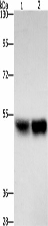 ZFYVE19 Polyclonal Antibody (E-AB-53235)