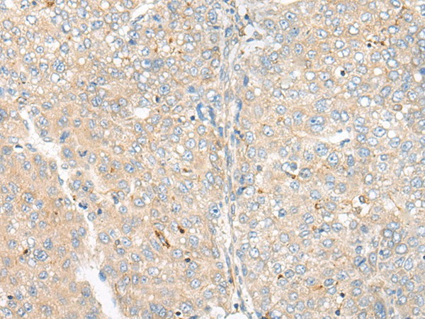 CAMK2A Polyclonal Antibody (E-AB-19660)
