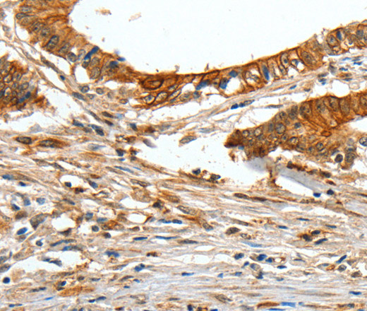 COL1A2 Polyclonal Antibody (E-AB-10155)