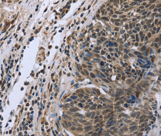 FANCG Polyclonal Antibody (E-AB-11217)