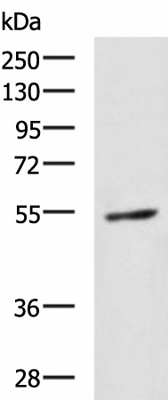 GBA Polyclonal Antibody (E-AB-19899)