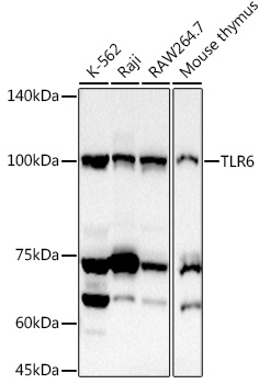 TLR6 Polyclonal Antibody (E-AB-92842)