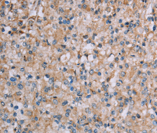 PLXNA4 Polyclonal Antibody (E-AB-13522)