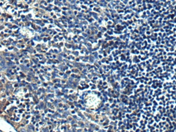PRRT2 Polyclonal Antibody (E-AB-19235)