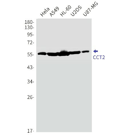 Recombinant CCT2 Monoclonal Antibody (E-AB-81498)