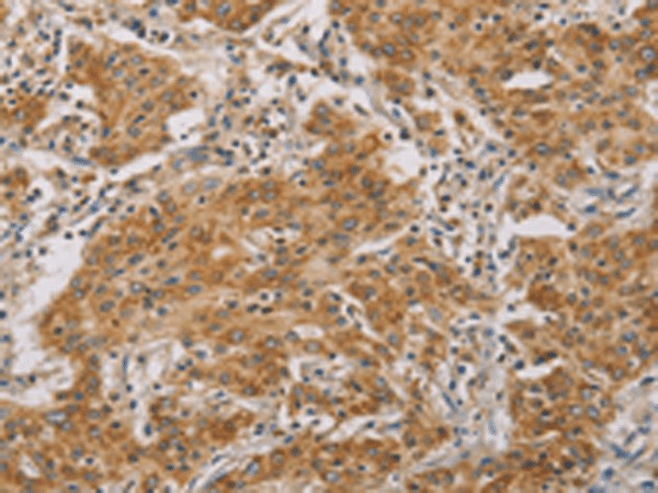 CDKN2A Polyclonal Antibody (E-AB-19334)
