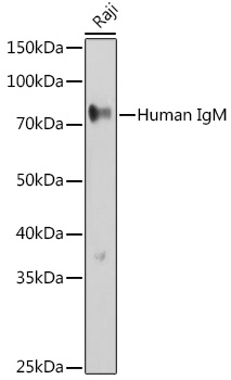 Human IgM Polyclonal Antibody (E-AB-92900)