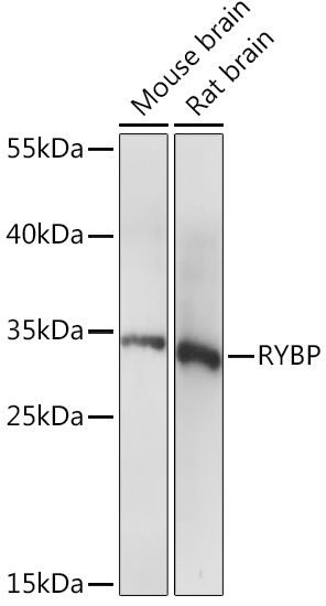 RYBP Polyclonal Antibody (E-AB-90904)