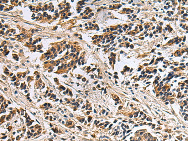 DIAPH2 Polyclonal Antibody (E-AB-19274)