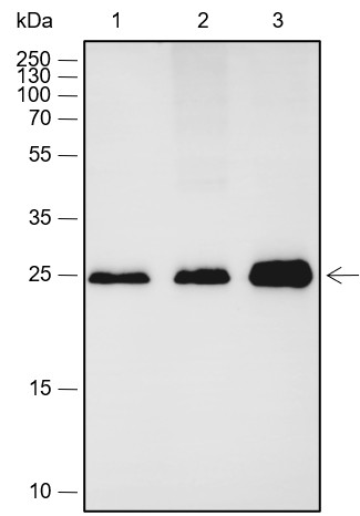 Recombinant Calbindin Monoclonal Antibody (AN301778L)