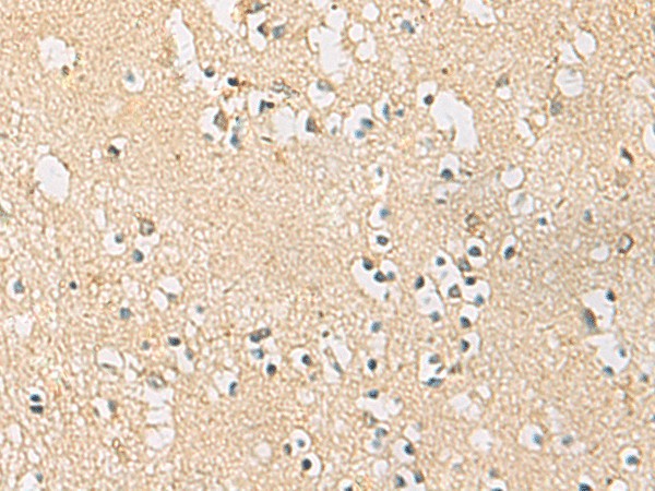PDE4DIP Polyclonal Antibody (E-AB-53137)