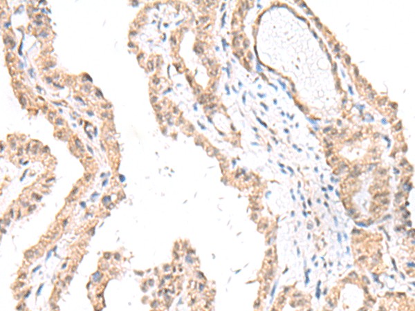FANCE Polyclonal Antibody (E-AB-17948)