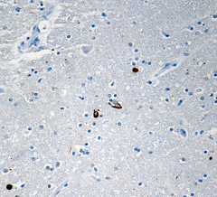 Purified anti-α-Synuclein, 80-96 Antibody (848301)