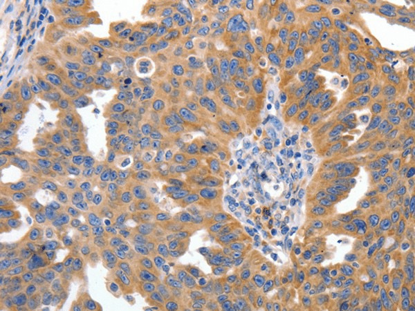IRS2 Polyclonal Antibody (E-AB-17345)