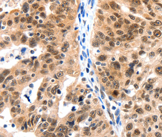 LRP5 Polyclonal Antibody (E-AB-15758)