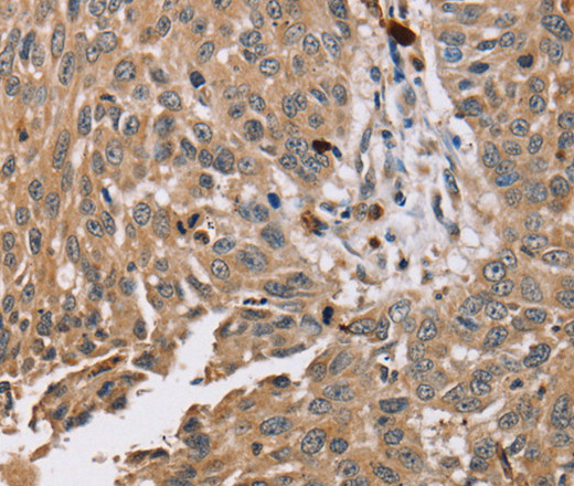 PDLIM7 Polyclonal Antibody (E-AB-11480)