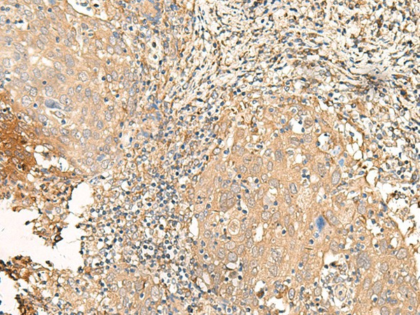 GALR2 Polyclonal Antibody (E-AB-19893)