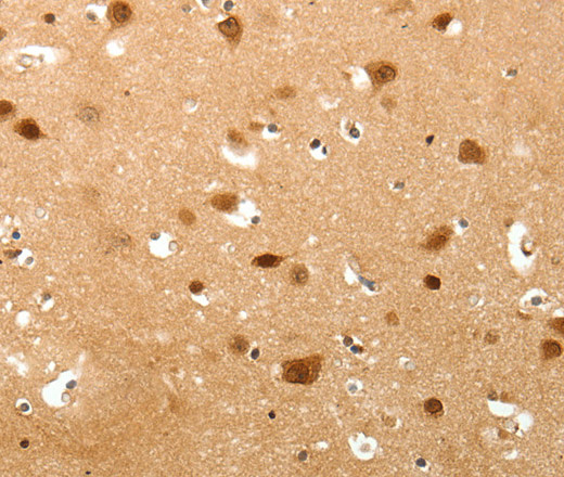 TNN Polyclonal Antibody (E-AB-12897)