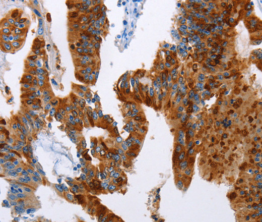 TFF3 Polyclonal Antibody (E-AB-10008)
