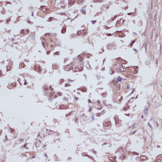 U2AF1 Polyclonal Antibody (E-AB-64485)