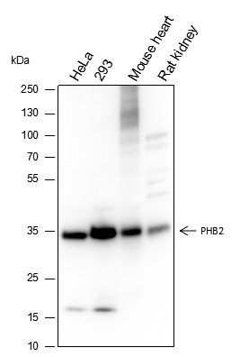 Recombinant PHB2 Monoclonal Antibody (AN301627L)