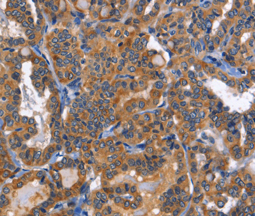 MUSK Polyclonal Antibody (E-AB-14689)