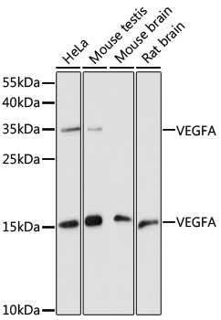 VEGFA Polyclonal Antibody (E-AB-64001)