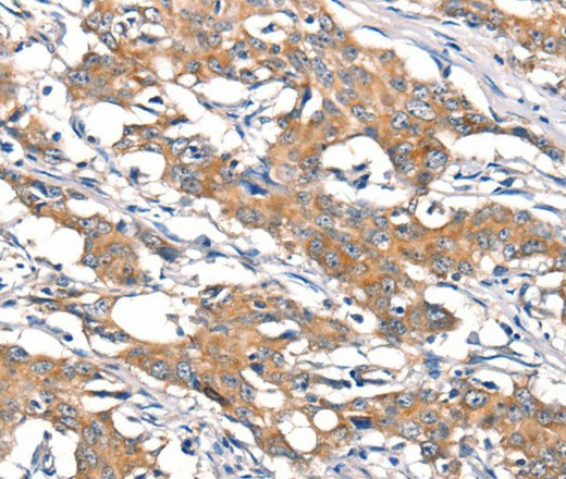 DSC1 Polyclonal Antibody (E-AB-16387)