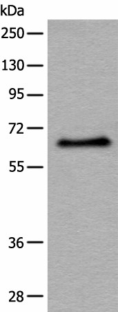 ATF7 Polyclonal Antibody (E-AB-18526)
