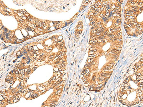 NOL8 Polyclonal Antibody (E-AB-17855)