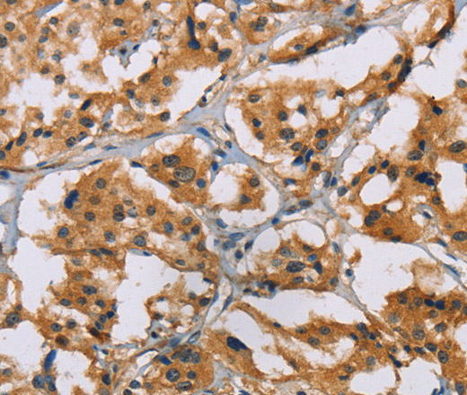 NRN1 Polyclonal Antibody (E-AB-14240)