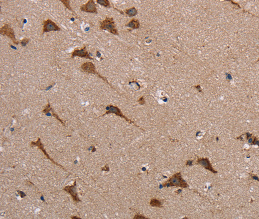 POMT1 Polyclonal Antibody (E-AB-13528)