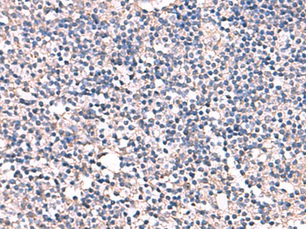 ESM1 Polyclonal Antibody (E-AB-52188)