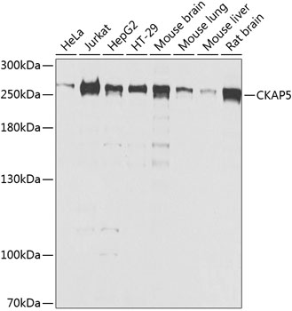 CKAP5 Polyclonal Antibody (E-AB-63010)