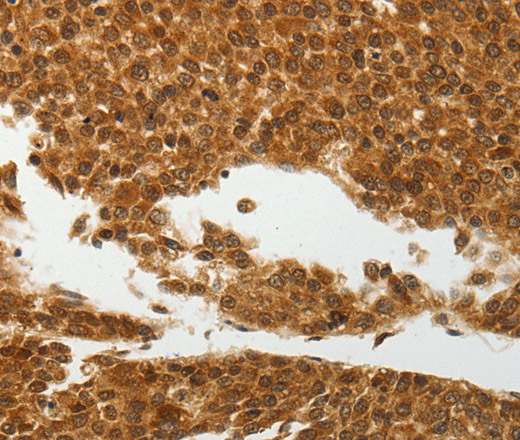 SOCS7 Polyclonal Antibody (E-AB-12649)
