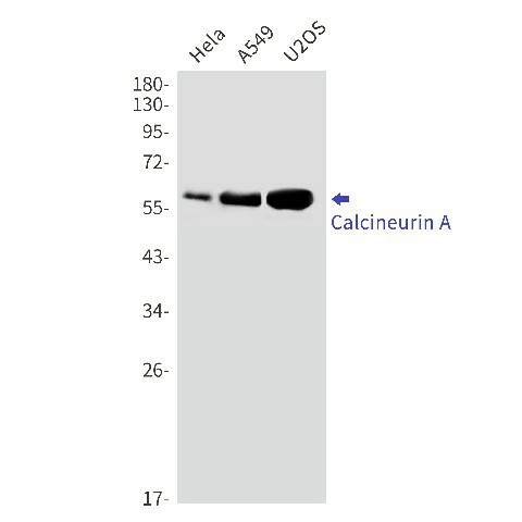 Recombinant Calcineurin A Monoclonal Antibody (E-AB-81538)