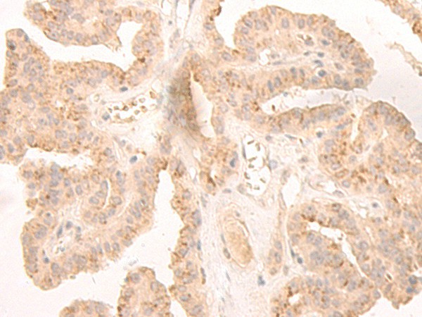 LCMT2 Polyclonal Antibody (E-AB-18747)