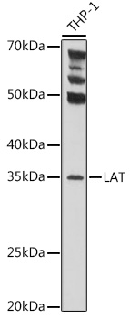 LAT Polyclonal Antibody (E-AB-92662)